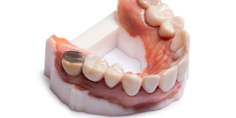 Stratasys Verovivid 3D Printed Dentures